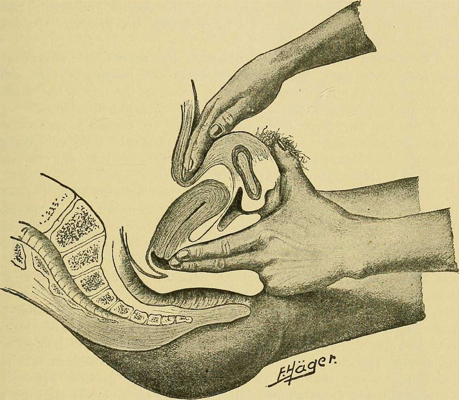 bimanual pelvic exam video