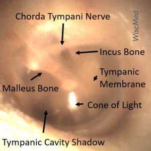 normal ear exam documentation