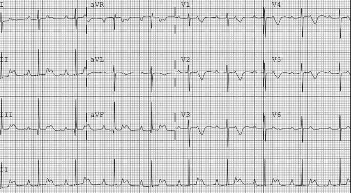 ecg academy final exam answers