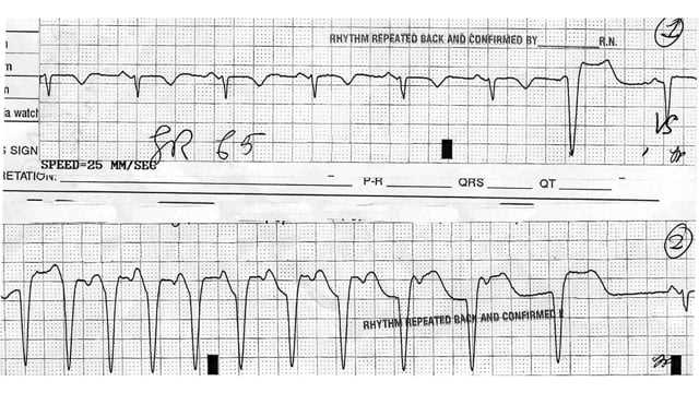 ecg academy final exam answers