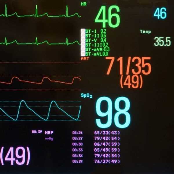 aha heartcode acls exam answers