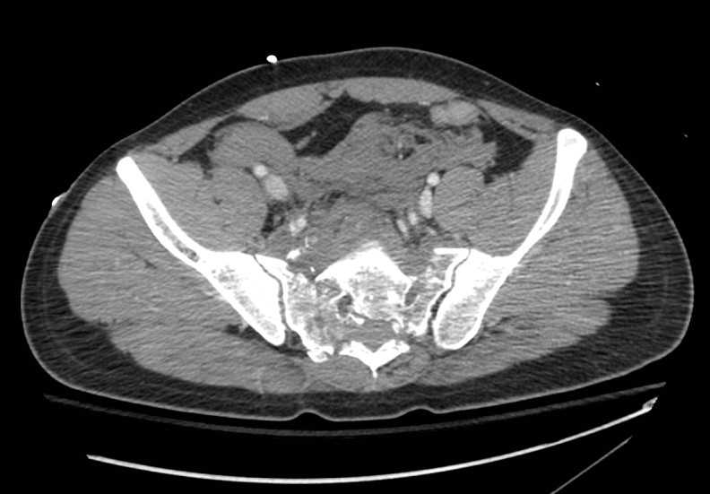 radiology board exam worksheet answers