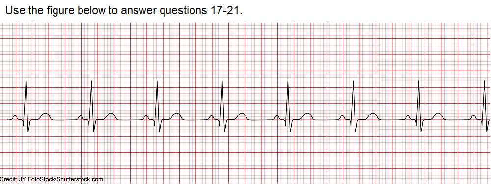 telemetry competency exam answers