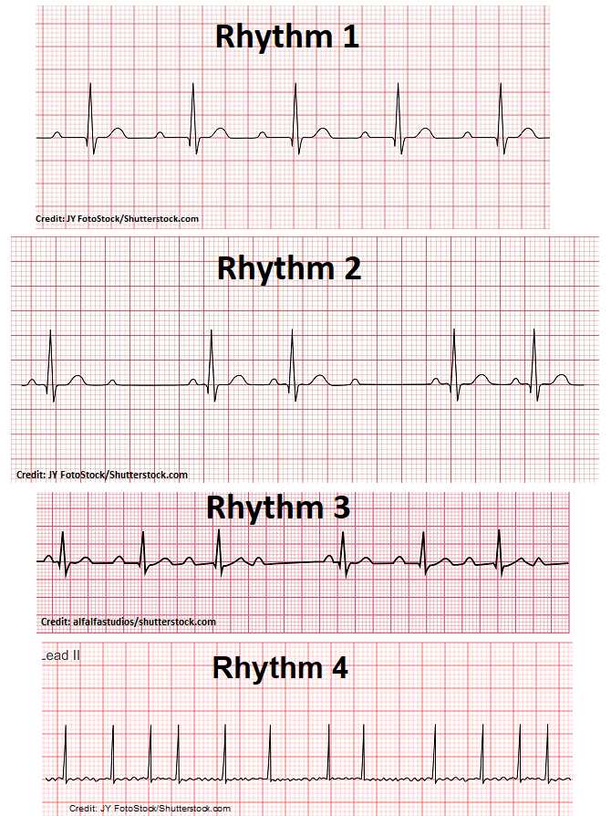 ecg academy final exam answers