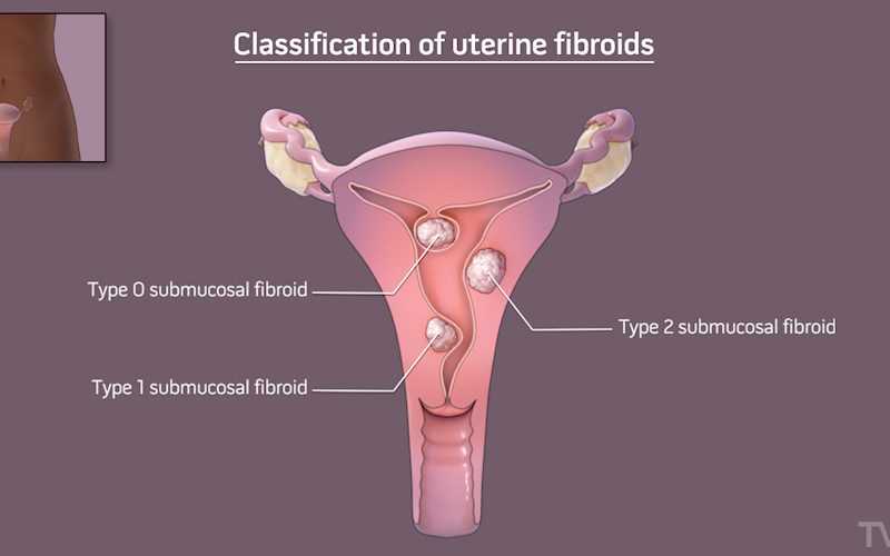 bimanual pelvic exam video