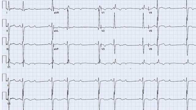 ecg academy final exam answers