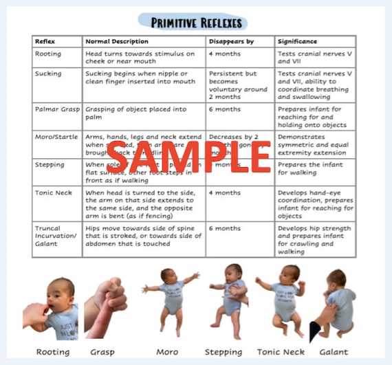 newborn physical exam write up