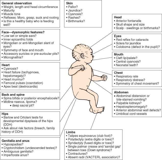 newborn physical exam write up