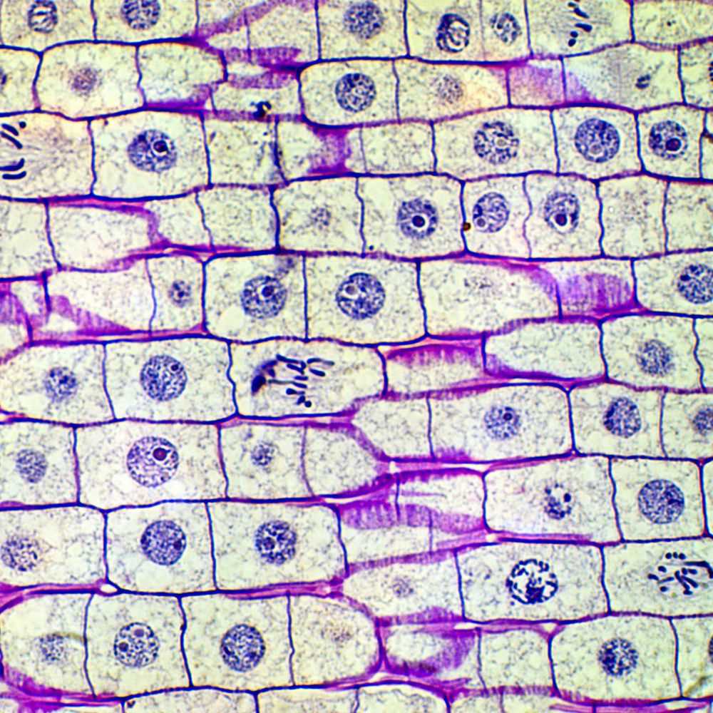 onion root tip mitosis lab worksheet answers