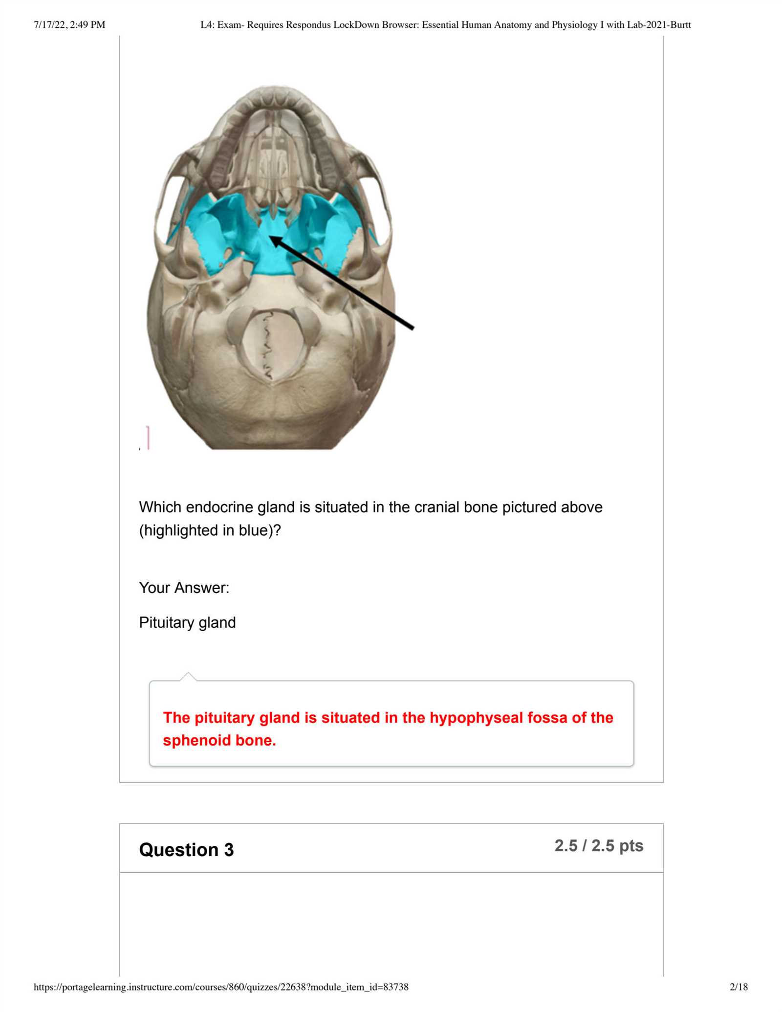 portage learning exam answers anatomy and physiology