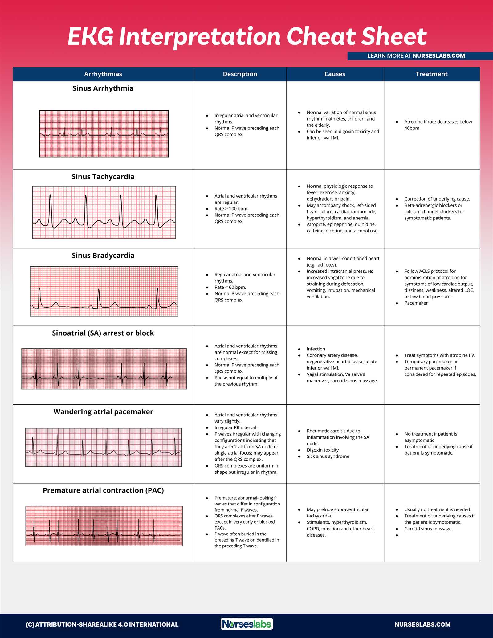 rn.com dysrhythmia exam advanced answers