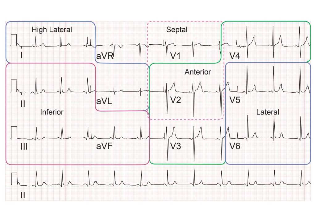 telemetry competency exam answers