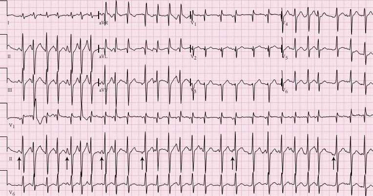 ecg academy final exam answers