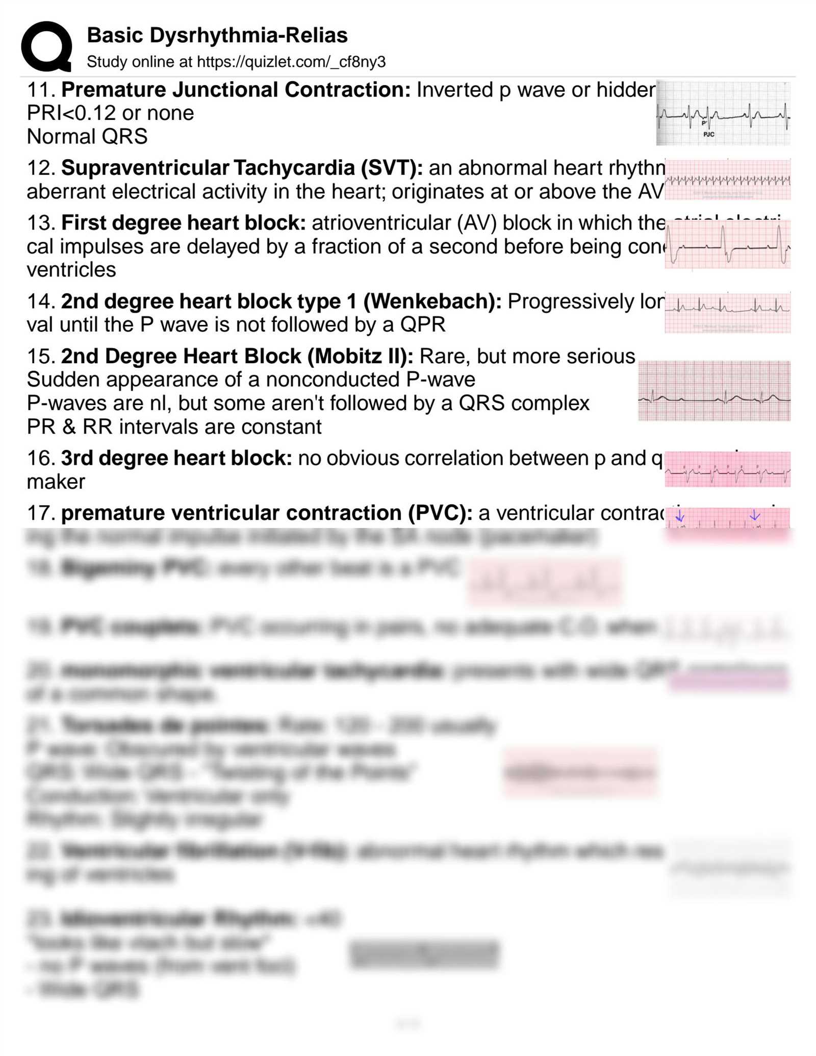 rn.com dysrhythmia exam advanced answers