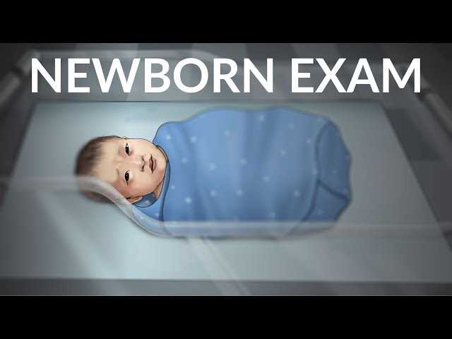 newborn physical exam write up