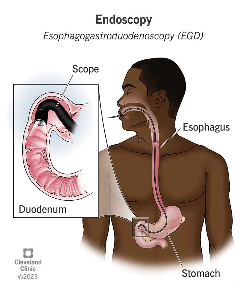 instrument used to examine the stomach