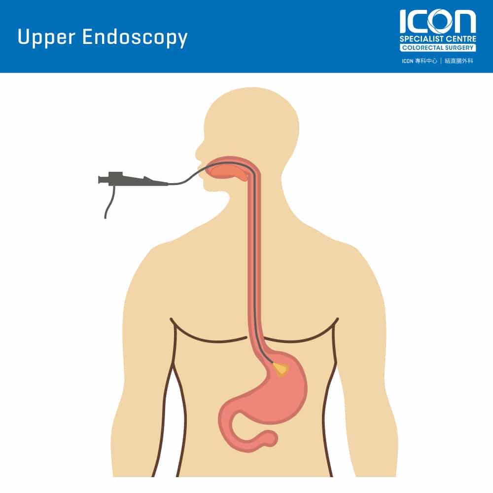 instrument used to examine the stomach